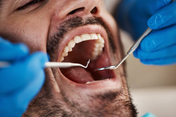 Best Emergency Dental Care for Broken or Chipped Teeth in Midway, FL